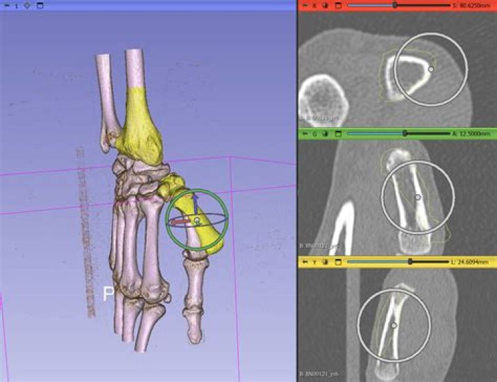 Height Analysis Of William Li