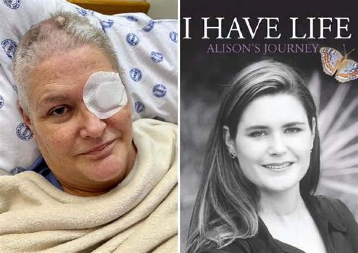 The Inspiring Alison Botha Story: A Tale of Unyielding Resilience and Personal Growth