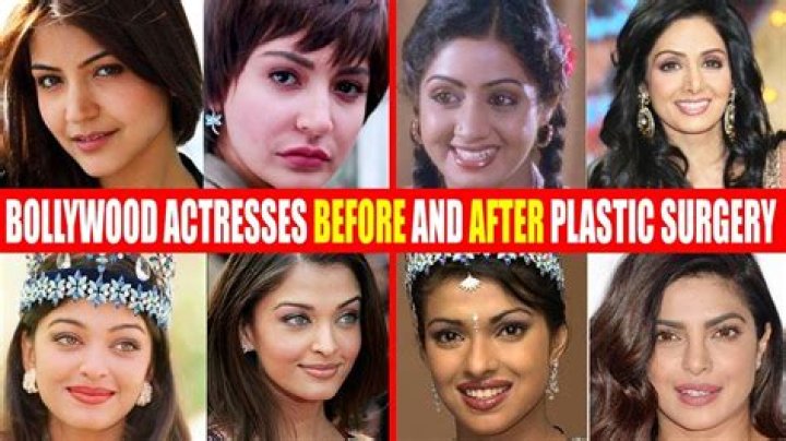 Which Actress Hasn't Done Plastic Surgery?
