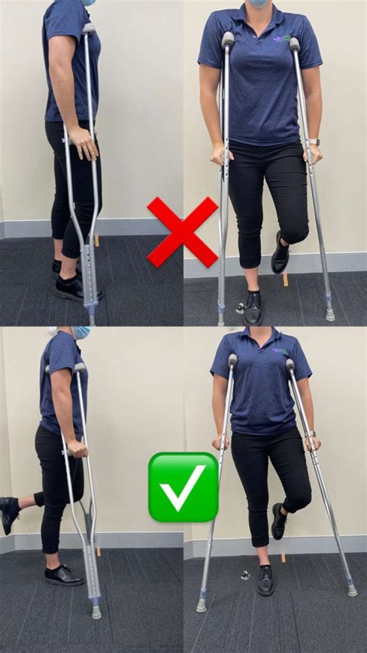 Why Does a Spice Girl Need Crutches? Unpacking the Reasons Behind Celebrity Mobility Aids